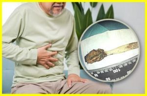 Китаєць 52 роки проходив із зубною щіткою в кишківнику